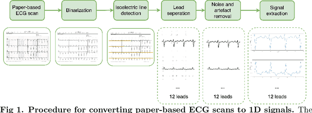 Figure 1 for Detecting COVID-19 from digitized ECG printouts using 1D convolutional neural networks
