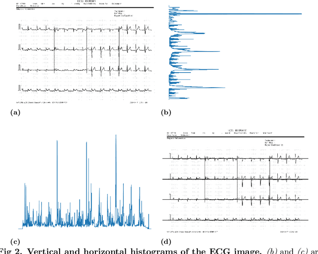 Figure 3 for Detecting COVID-19 from digitized ECG printouts using 1D convolutional neural networks