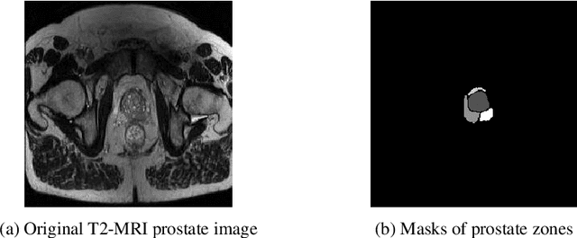 Figure 3 for Comparison of automatic prostate zones segmentation models in MRI images using U-net-like architectures