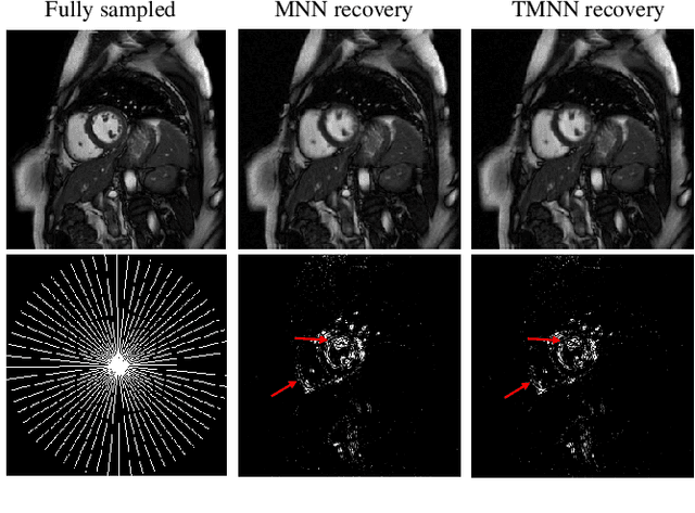 Figure 1 for Dynamic Cardiac MRI Reconstruction Using Combined Tensor Nuclear Norm and Casorati Matrix Nuclear Norm Regularizations