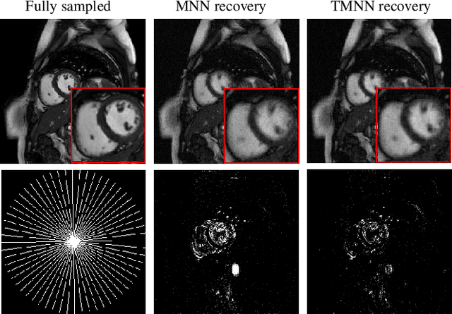 Figure 3 for Dynamic Cardiac MRI Reconstruction Using Combined Tensor Nuclear Norm and Casorati Matrix Nuclear Norm Regularizations