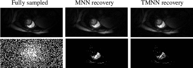 Figure 4 for Dynamic Cardiac MRI Reconstruction Using Combined Tensor Nuclear Norm and Casorati Matrix Nuclear Norm Regularizations