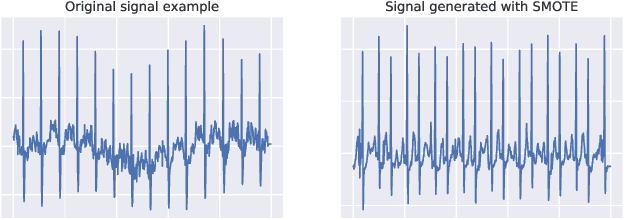 Figure 3 for Data Augmentation for Electrocardiograms