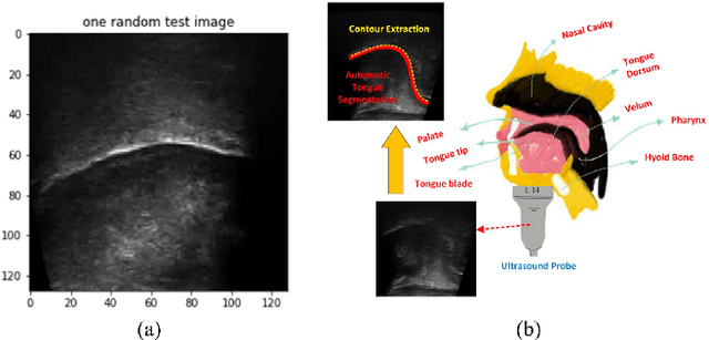 Figure 1 for Real-time Ultrasound-enhanced Multimodal Imaging of Tongue using 3D Printable Stabilizer System: A Deep Learning Approach