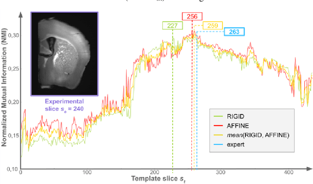 Figure 1 for Automated Atlas-based Segmentation of Single Coronal Mouse Brain Slices using Linear 2D-2D Registration