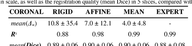 Figure 3 for Automated Atlas-based Segmentation of Single Coronal Mouse Brain Slices using Linear 2D-2D Registration
