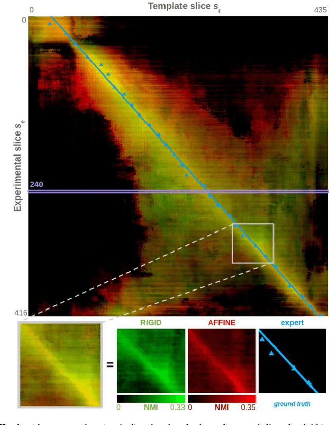 Figure 2 for Automated Atlas-based Segmentation of Single Coronal Mouse Brain Slices using Linear 2D-2D Registration