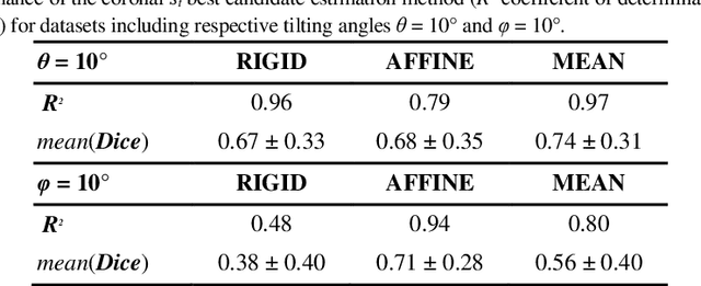 Figure 4 for Automated Atlas-based Segmentation of Single Coronal Mouse Brain Slices using Linear 2D-2D Registration