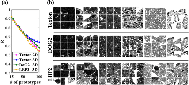 Figure 3 for Explaining Radiological Emphysema Subtypes with Unsupervised Texture Prototypes: MESA COPD Study