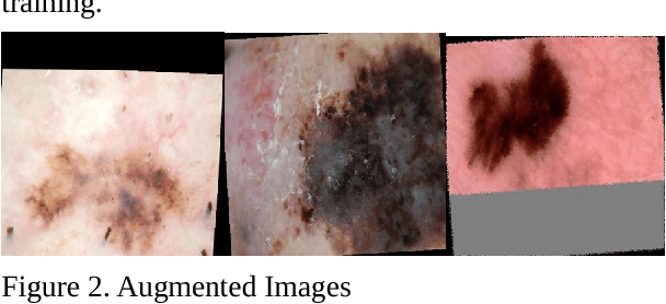 Figure 1 for Automated Skin Lesion Classification Using Ensemble of Deep Neural Networks in ISIC 2018: Skin Lesion Analysis Towards Melanoma Detection Challenge