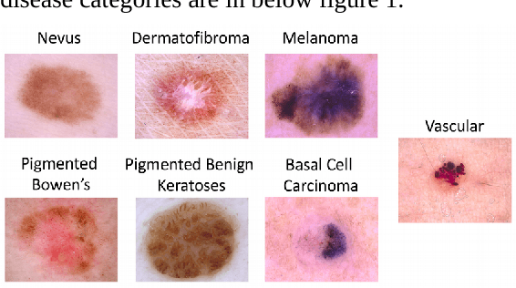 Figure 2 for Automated Skin Lesion Classification Using Ensemble of Deep Neural Networks in ISIC 2018: Skin Lesion Analysis Towards Melanoma Detection Challenge