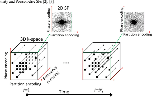 Figure 1 for Alternating Learning Approach for Variational Networks and Undersampling Pattern in Parallel MRI Applications