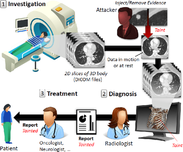 Figure 2 for CT-GAN: Malicious Tampering of 3D Medical Imagery using Deep Learning