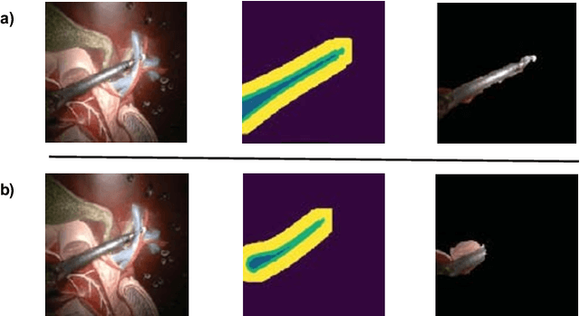 Figure 3 for Self-Supervised Surgical Tool Segmentation using Kinematic Information