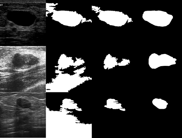 Figure 4 for Evolving Fuzzy Image Segmentation with Self-Configuration