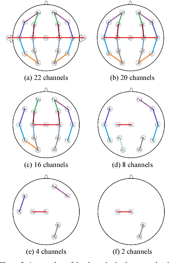 Figure 3 for Optimizing Channel Selection for Seizure Detection