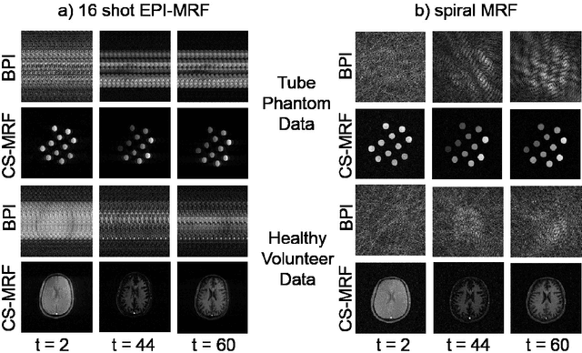 Figure 2 for Balanced multi-shot EPI for accelerated Cartesian MRF: An alternative to spiral MRF