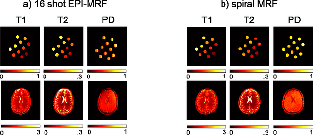 Figure 4 for Balanced multi-shot EPI for accelerated Cartesian MRF: An alternative to spiral MRF
