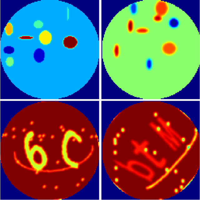 Figure 1 for Deep Convolutional Neural Network for Low Projection SPECT Imaging Reconstruction