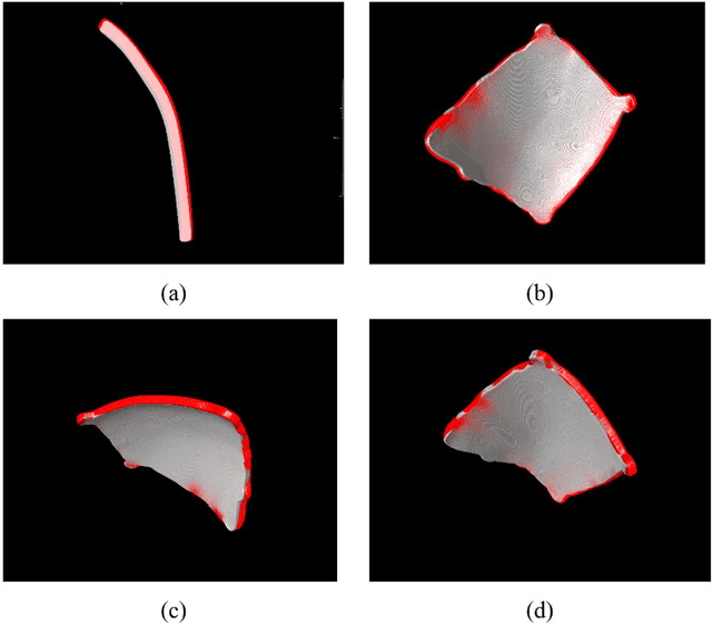 Figure 4 for Computer-aided implant design for the restoration of cranial defects