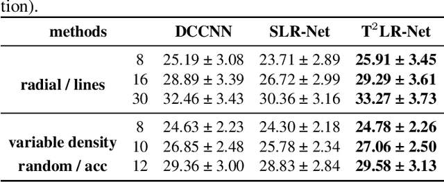 Figure 4 for T$^2$LR-Net: An Unrolling Reconstruction Network Learning Transformed Tensor Low-Rank prior for Dynamic MR Imaging