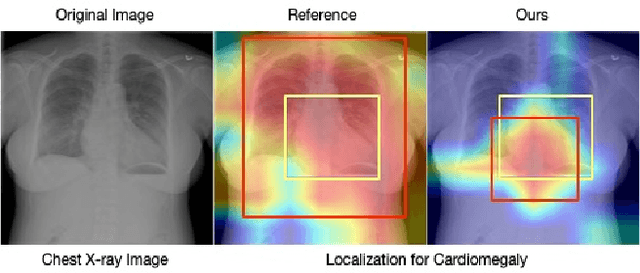 Figure 1 for Cross-Modal Contrastive Learning for Abnormality Classification and Localization in Chest X-rays with Radiomics using a Feedback Loop