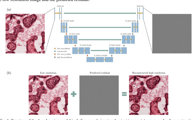 Figure 1 for Resolution enhancement of placenta histological images using deep learning