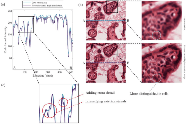 Figure 2 for Resolution enhancement of placenta histological images using deep learning
