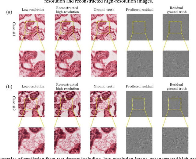 Figure 3 for Resolution enhancement of placenta histological images using deep learning