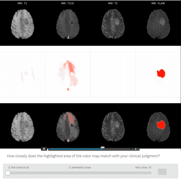 Figure 1 for Evaluating Explainable AI on a Multi-Modal Medical Imaging Task: Can Existing Algorithms Fulfill Clinical Requirements?