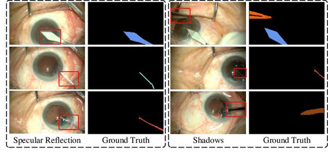 Figure 1 for Attention-Guided Lightweight Network for Real-Time Segmentation of Robotic Surgical Instruments