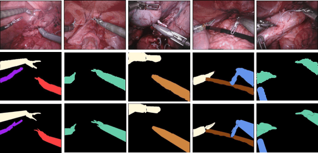 Figure 4 for Attention-Guided Lightweight Network for Real-Time Segmentation of Robotic Surgical Instruments