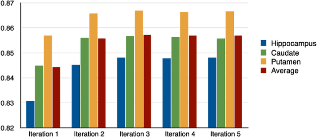 Figure 2 for Feature Sensitive Label Fusion with Random Walker for Atlas-based Image Segmentation