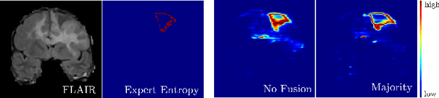 Figure 4 for On the Effect of Inter-observer Variability for a Reliable Estimation of Uncertainty of Medical Image Segmentation