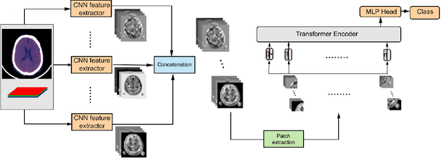 Figure 1 for Scopeformer: n-CNN-ViT Hybrid Model for Intracranial Hemorrhage Classification
