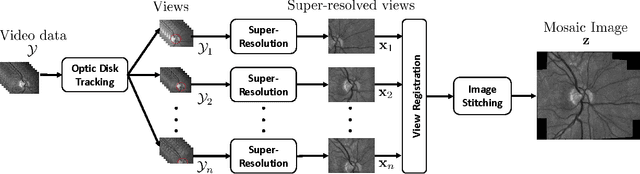 Figure 1 for Super-Resolved Retinal Image Mosaicing