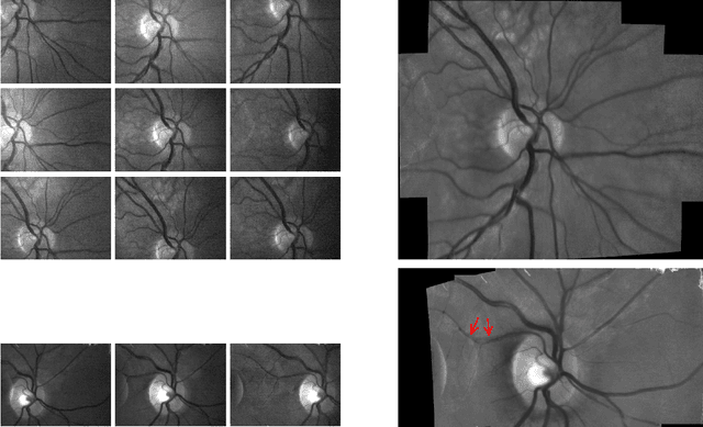 Figure 2 for Super-Resolved Retinal Image Mosaicing