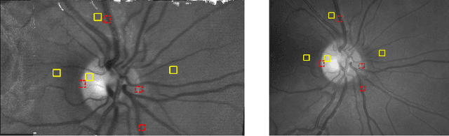 Figure 4 for Super-Resolved Retinal Image Mosaicing