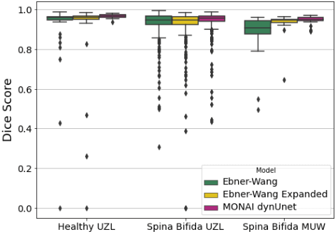 Figure 1 for MONAIfbs: MONAI-based fetal brain MRI deep learning segmentation