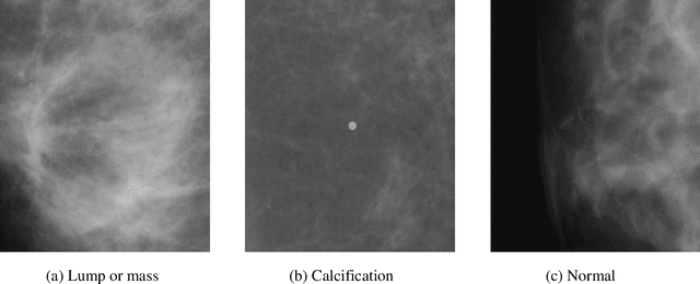 Figure 1 for Diagnosis of Breast Cancer using Hybrid Transfer Learning