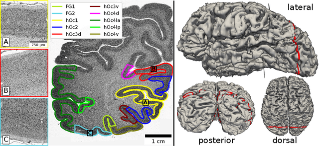 Figure 1 for 2D histology meets 3D topology: Cytoarchitectonic brain mapping with Graph Neural Networks