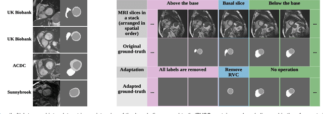 Figure 1 for 3D Consistent & Robust Segmentation of Cardiac Images by Deep Learning with Spatial Propagation