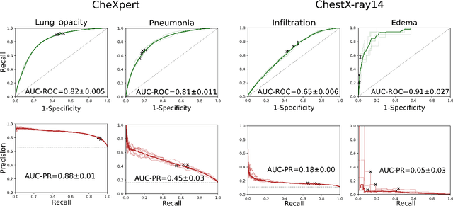 Figure 4 for Understanding the impact of class imbalance on the performance of chest x-ray image classifiers