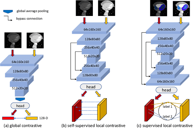 Figure 1 for Semi-supervised Contrastive Learning for Label-efficient Medical Image Segmentation