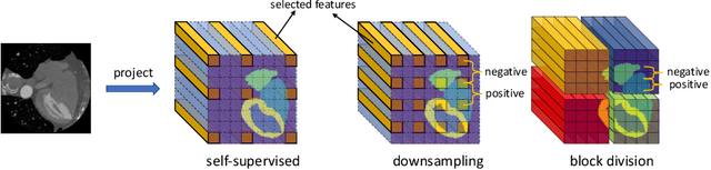 Figure 3 for Semi-supervised Contrastive Learning for Label-efficient Medical Image Segmentation