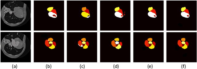 Figure 4 for Semi-supervised Contrastive Learning for Label-efficient Medical Image Segmentation