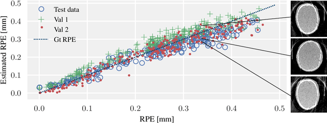 Figure 1 for Image Quality Assessment for Rigid Motion Compensation