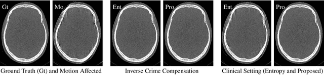 Figure 3 for Image Quality Assessment for Rigid Motion Compensation