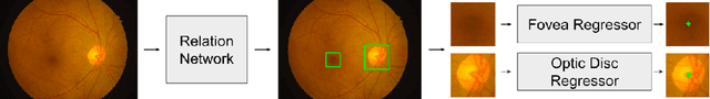 Figure 1 for Relation Networks for Optic Disc and Fovea Localization in Retinal Images