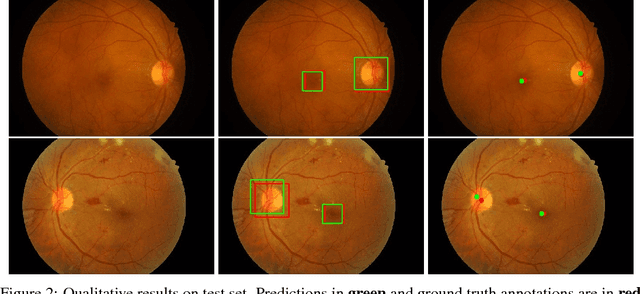 Figure 3 for Relation Networks for Optic Disc and Fovea Localization in Retinal Images